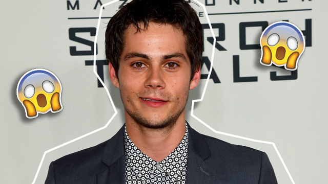 Dylan O'Brien After Accident