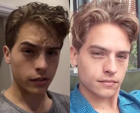 Dylan Sprouse Hair