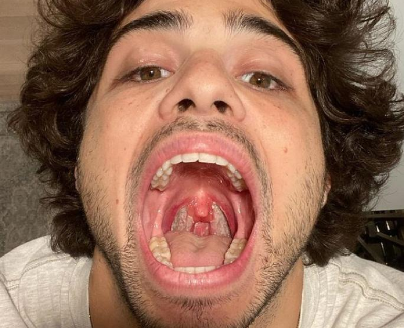 Noah Centineo tonsils
