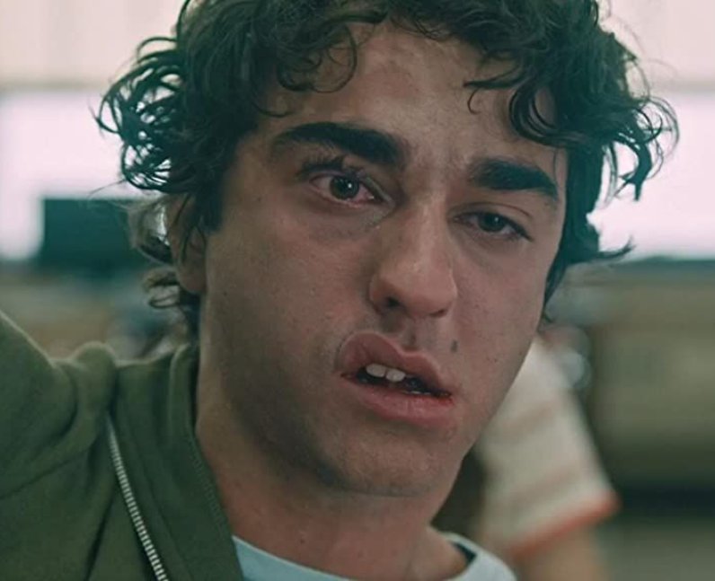 Did Alex Wolff dislocate his jaw in Hereditary?